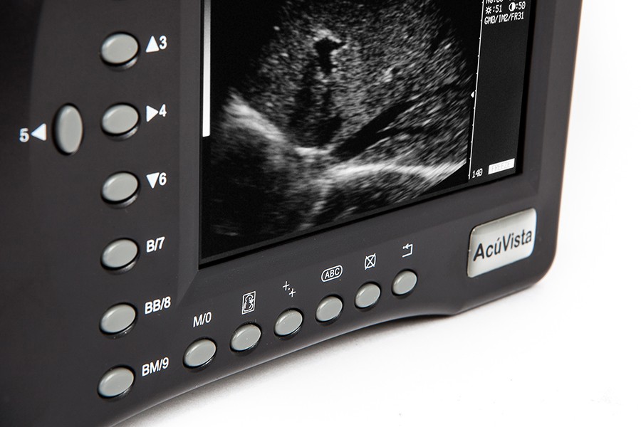 Ультразвуковой сканер AcuVista RS880b (c 1 датчиком, портативный)
