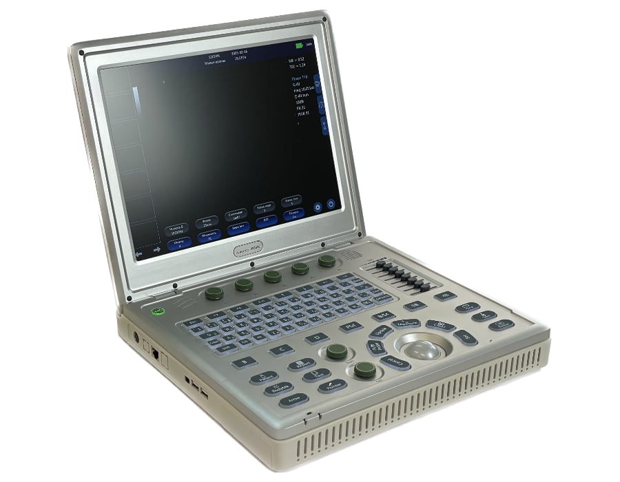 Ультразвуковой сканер AcuVista RS880c (c 1 датчиком, 15", с батареей)