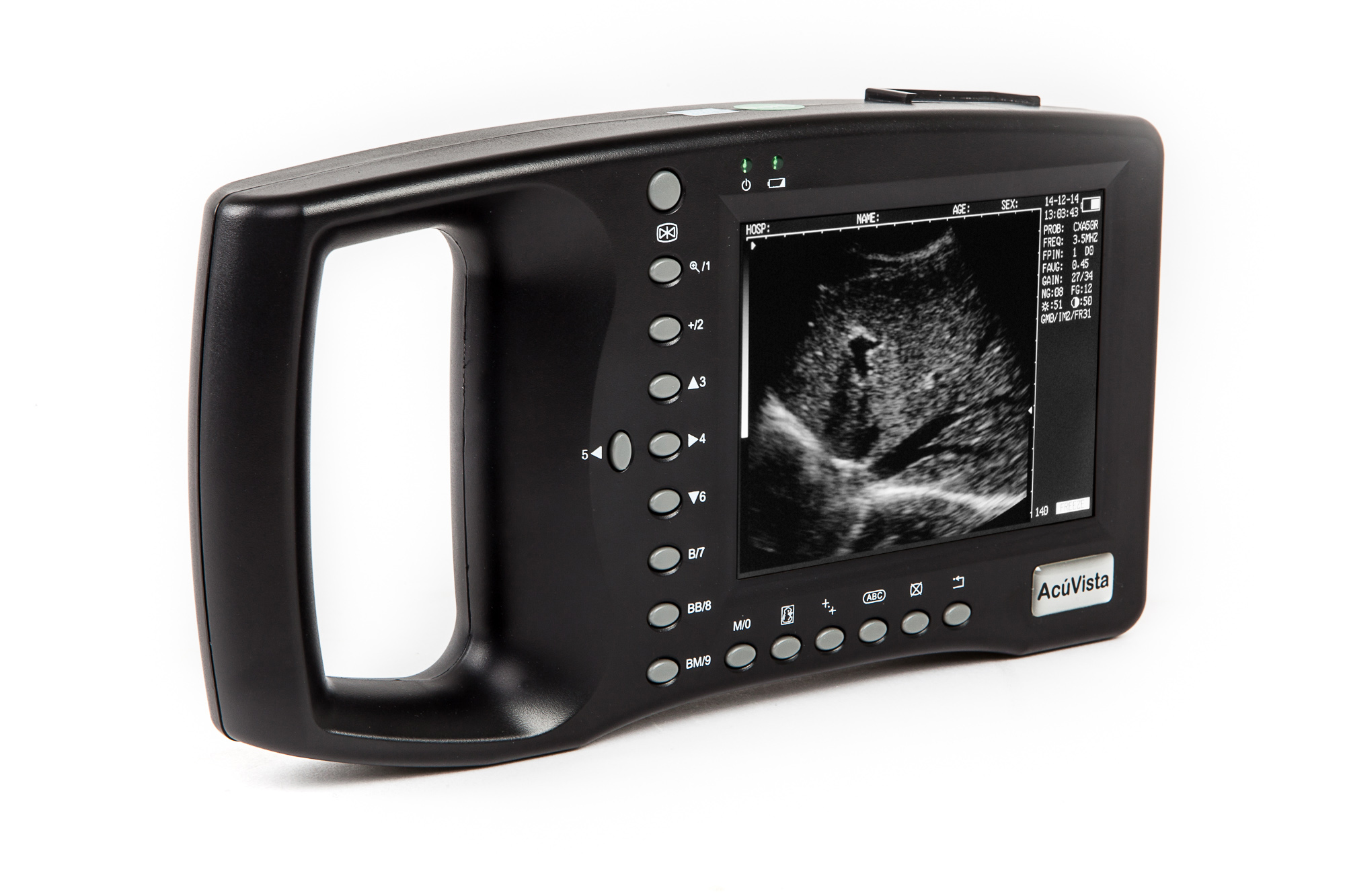 Ультразвуковой сканер AcuVista RS880b (c 1 датчиком, портативный)