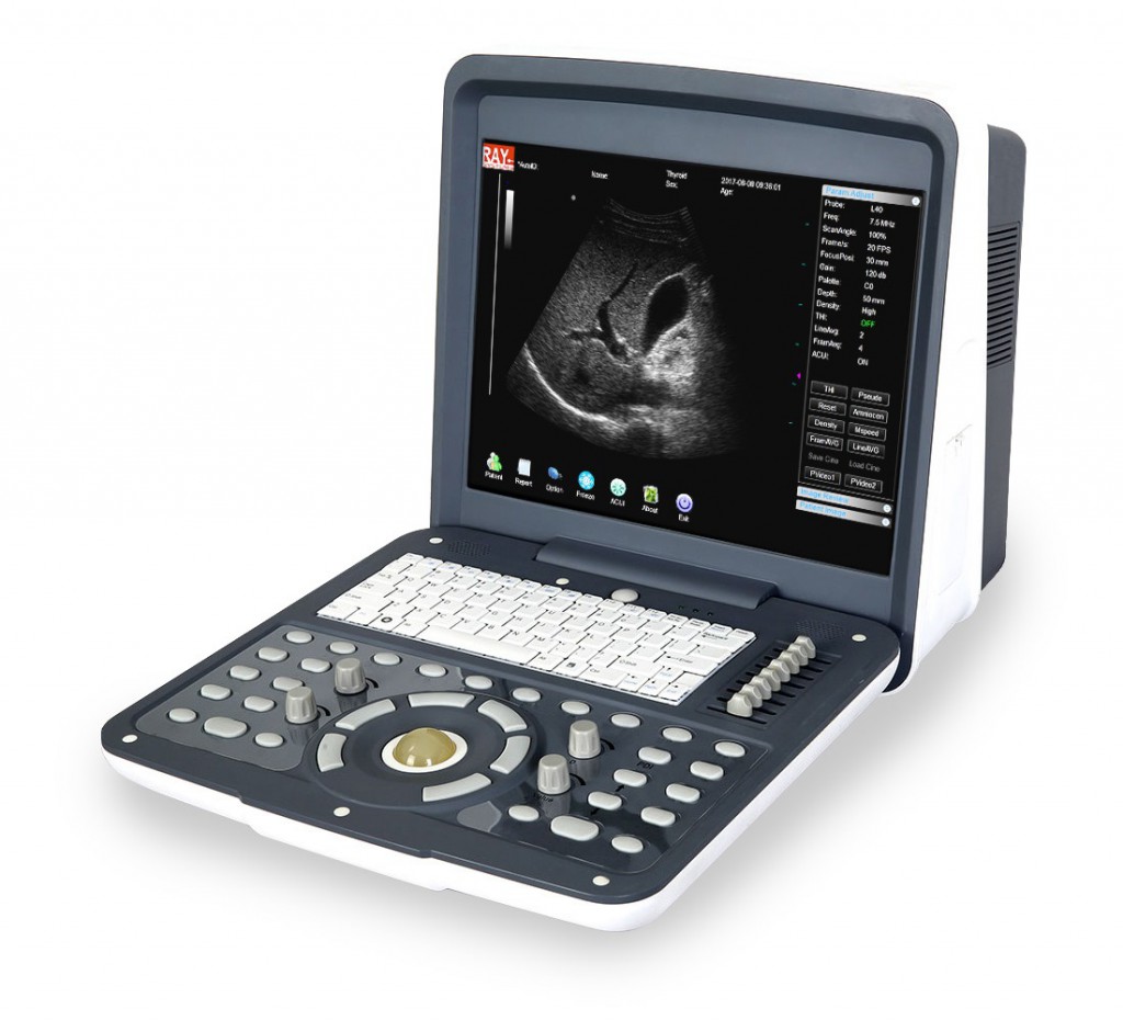 Ультразвуковой сканер AcuVista RS880d (c 3 датчиками, 14", с батареей)
