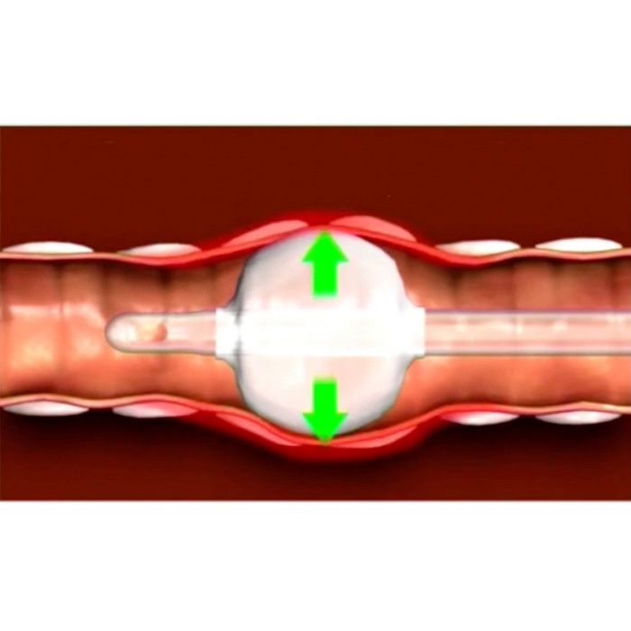 KRUUSE манометр для измерения давления и объёма манжеты эндотрахеальной трубки