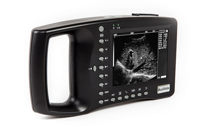 Ультразвуковой сканер AcuVista RS880b (c 1 датчиком, портативный)