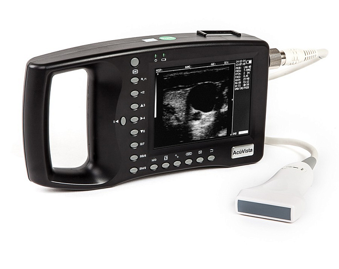 Ультразвуковой сканер AcuVista RS880b (c 1 датчиком, портативный)