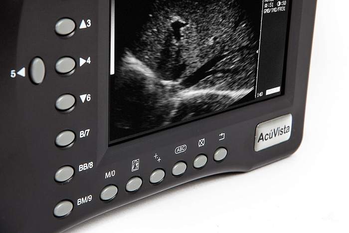 Ультразвуковой сканер AcuVista RS880b (c 1 датчиком, портативный)