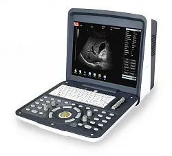 Ультразвуковой сканер AcuVista RS880d (c 1 датчиком, 14", с батареей) Ультразвуковой сканер AcuVista RS880d (c 1 датчиком, 14", с батареей)